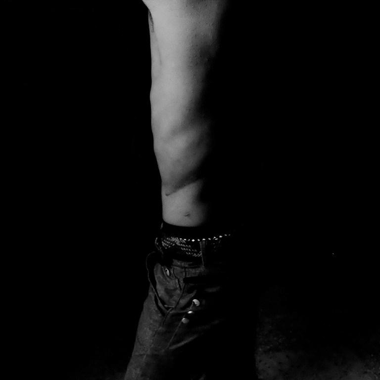 illegal trafficking of organs with Sudan  refugees in Egypt